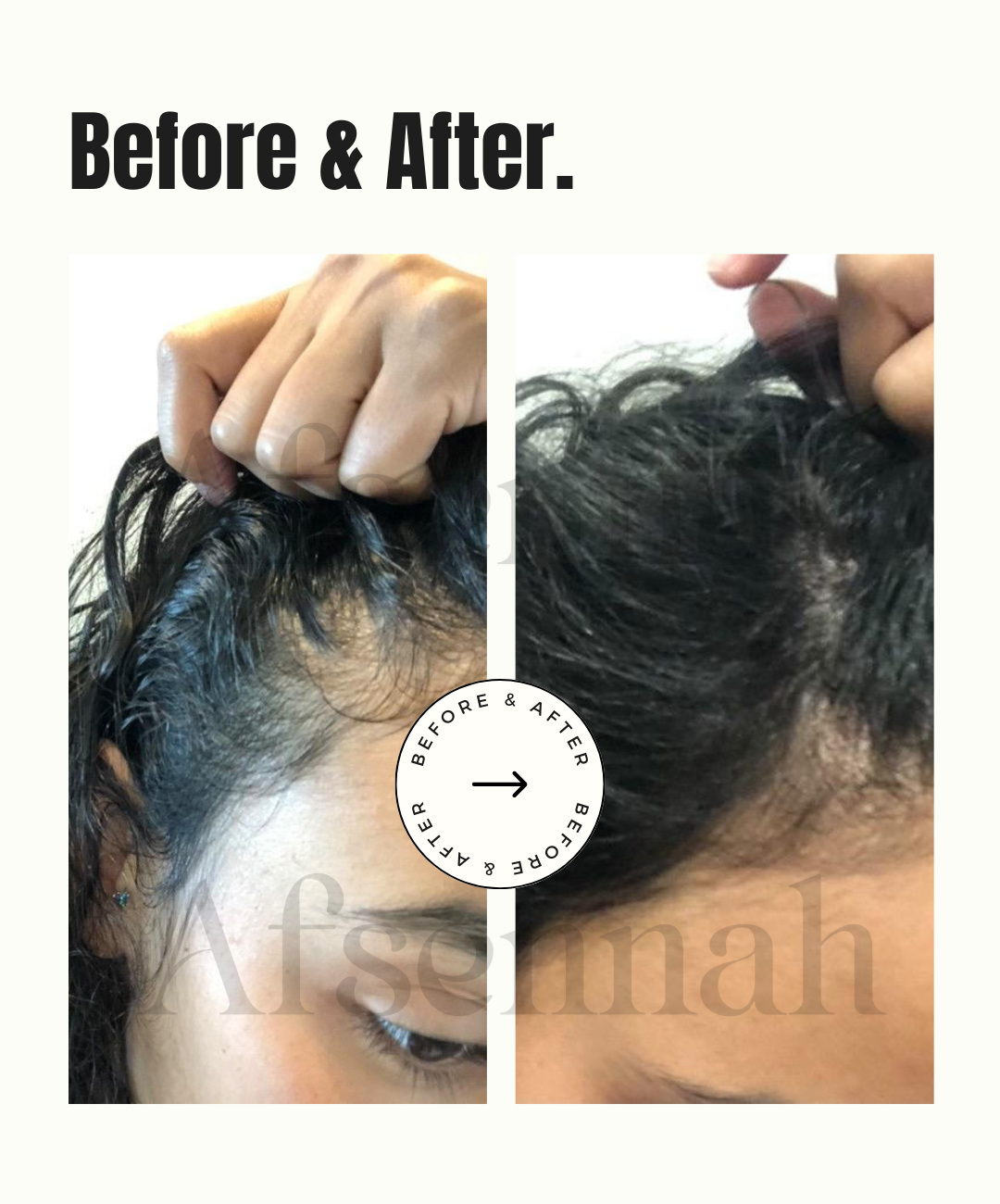 Custom Hair Growth Scalp Treatment