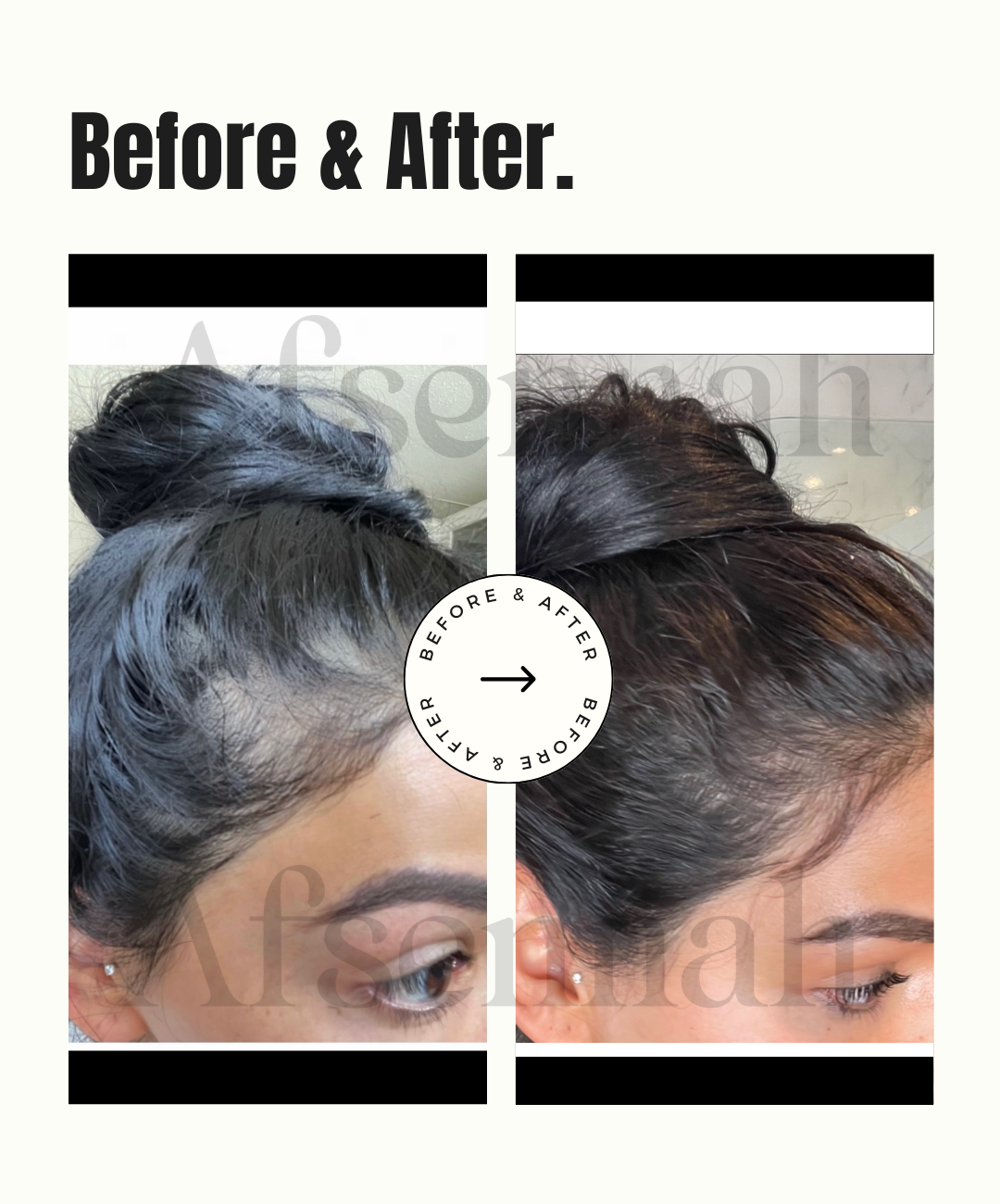 Custom Hair Growth Scalp Treatment